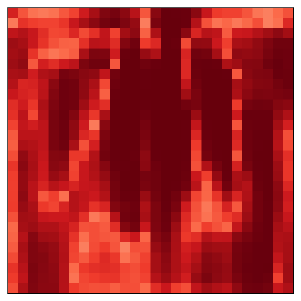 ChestMNIST feature importance map for the cardiomegaly class, with a wider high-importance region corresponding to an enlarged heart.